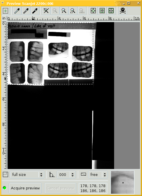 Preview scan of 8 dental intraoral X-ray films.
